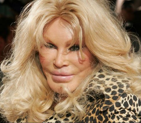 See Jocelyn Wildenstein, "Catwoman of Hollywood" looks like now 1 1 13