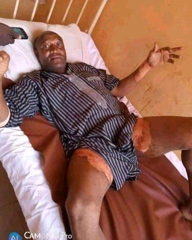 Wife Pours Hot Water on Husband's 'Cucumber' Over Plan to Marry 2nd Wife After 10 Kids (Photos) 3 Mallam Aliyu Ibrahim3