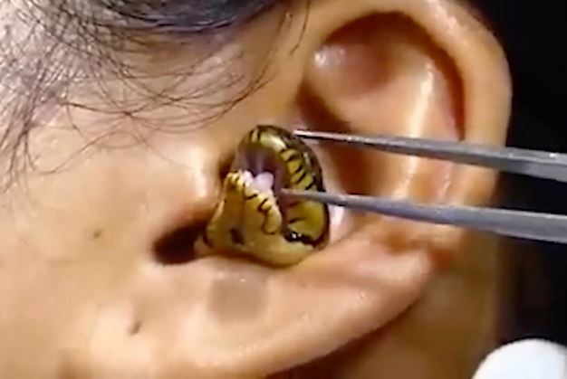 small enters human ear